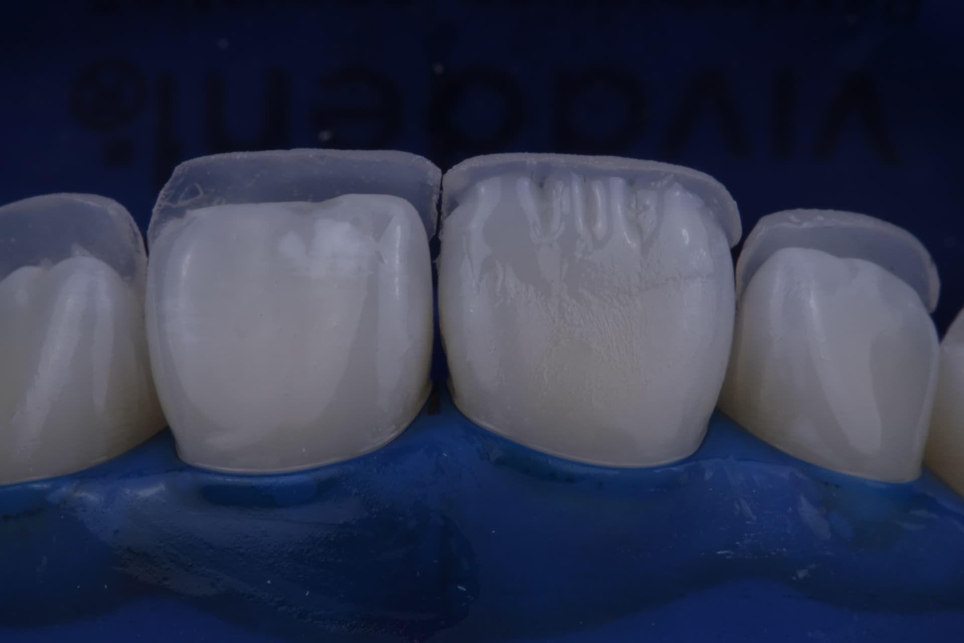 Textura e caracterização de superfície